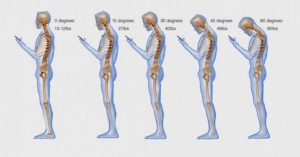 cell-phone-text-messaging-posture-1030x538-2