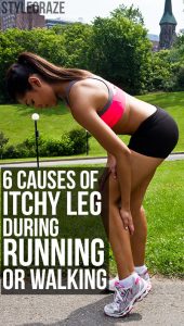 6-Serious-Causes-Of-Itchy-Leg-During-Running-Or-Walking