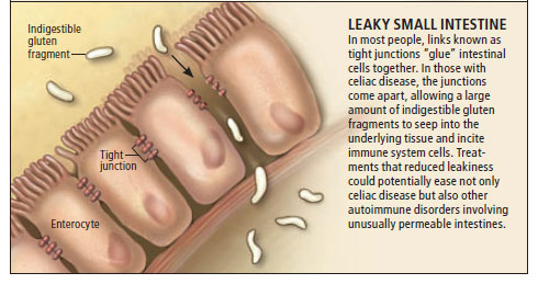 tight-junction-leak